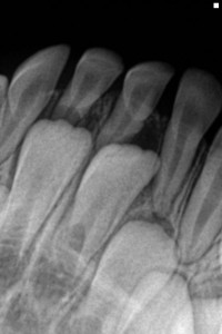 Dental check ups recommended for children and their transitioning teeth