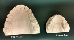 upper and lower jaw