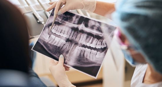 A woman holds an X-ray image of her teeth