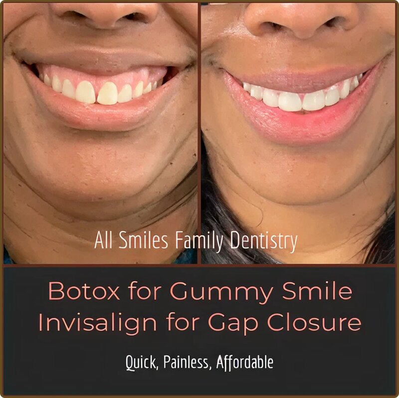 All Smiles Family Dentistry