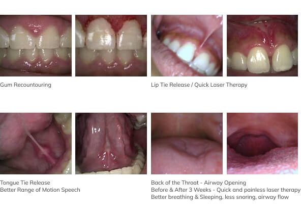 Left All Smiles Family Dentistry