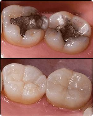 dental emergency